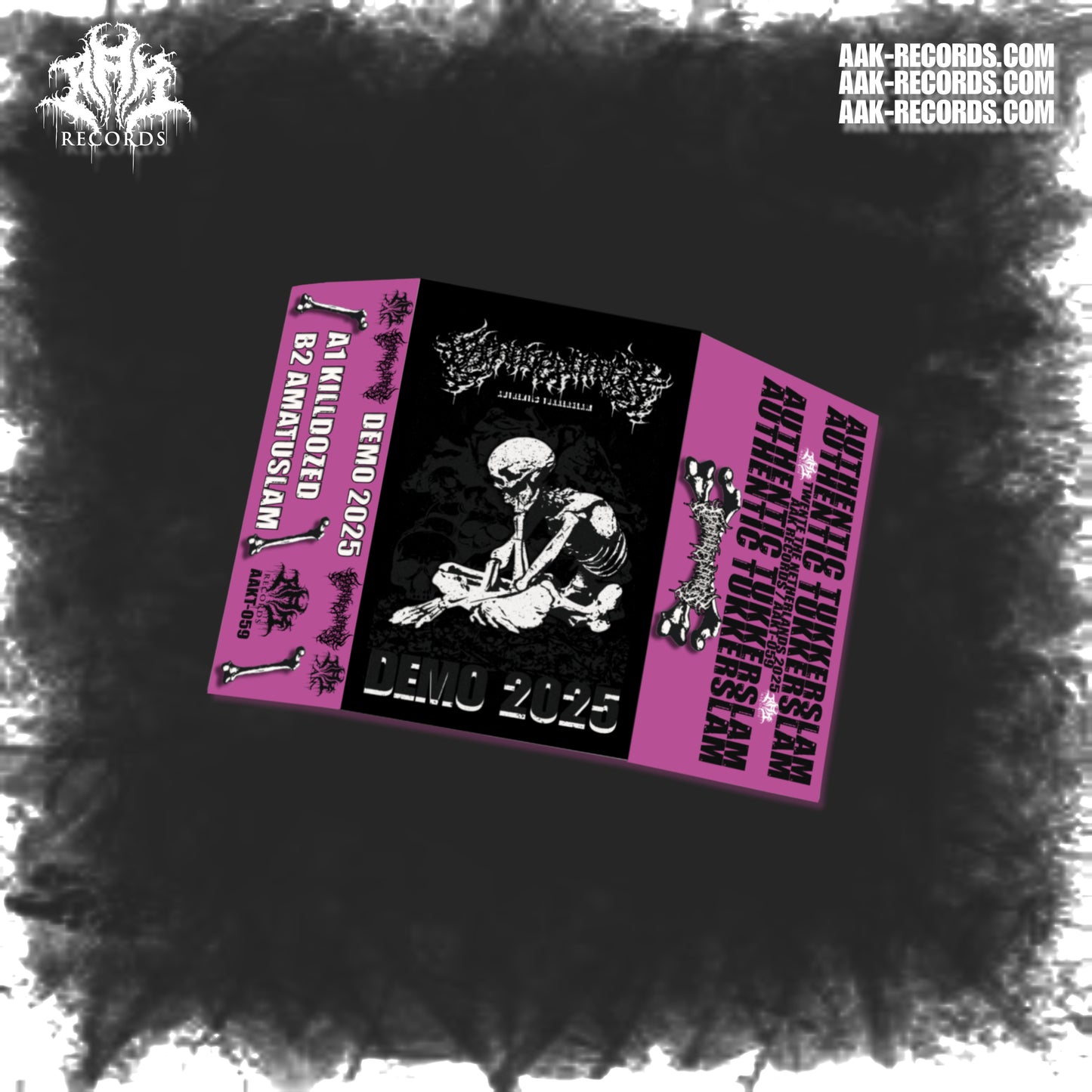 BACKHOELOADER - "DEMO 2025" [TAPE]